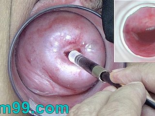 Coryza cámara endoscopio japonés dentro del cuello uterino en depress vagina Cam
